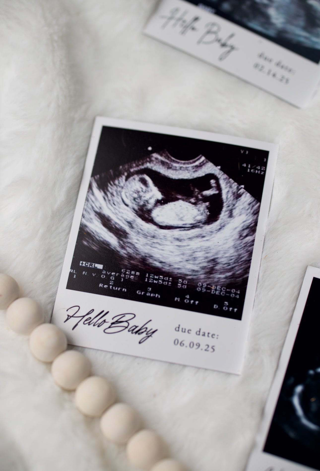 Custom First Image Ultrasound Magnet