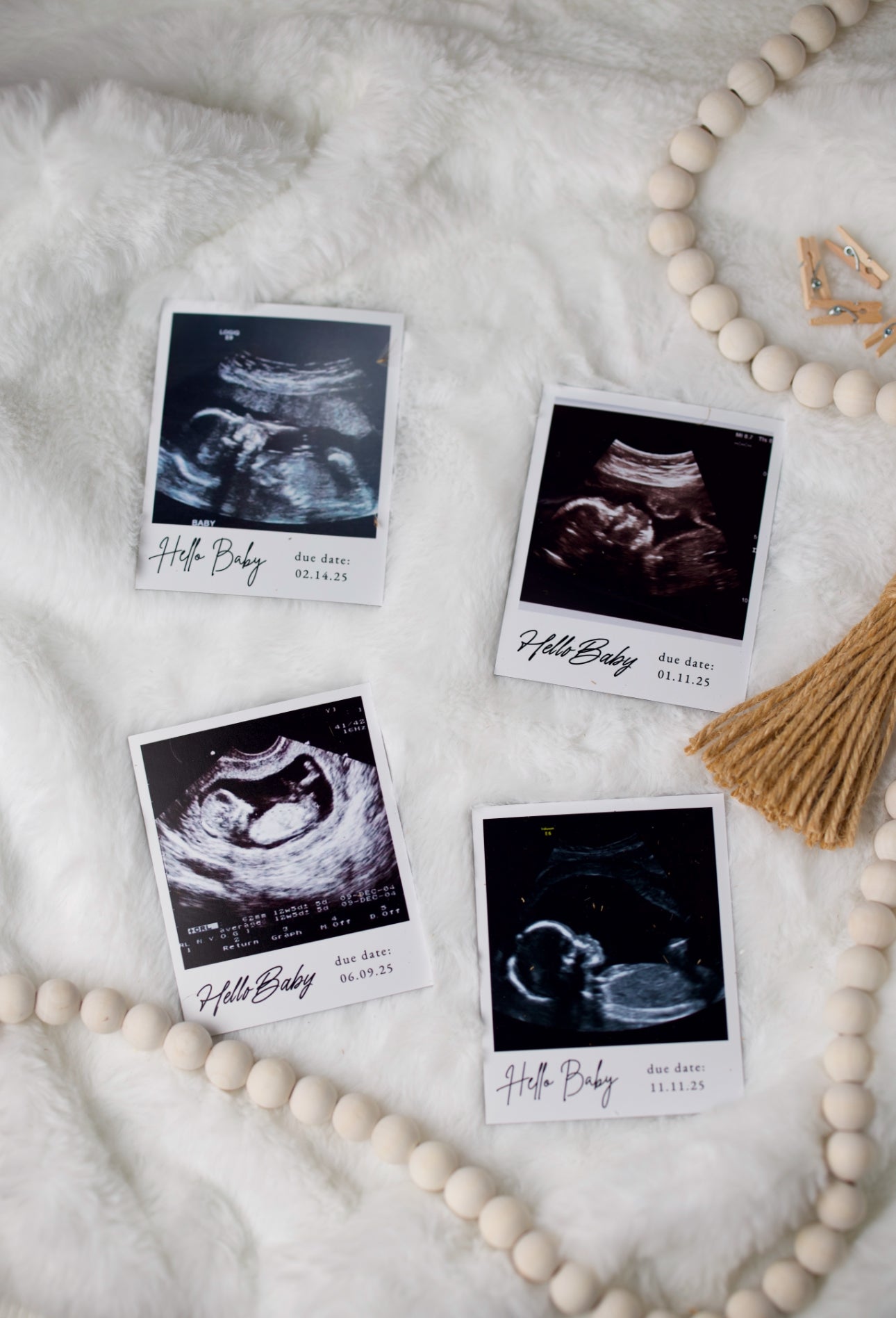 Custom First Image Ultrasound Magnet