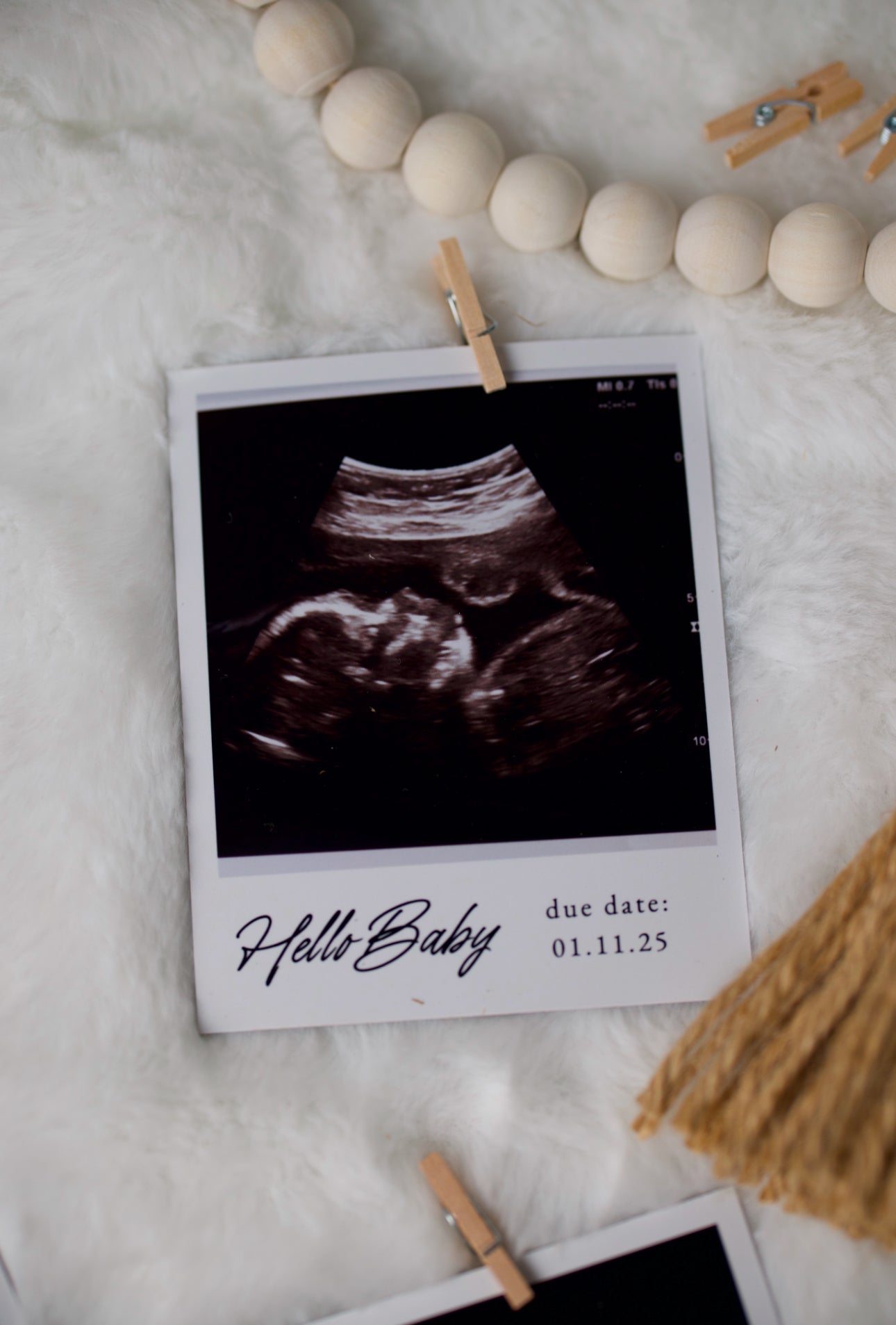 Custom First Image Ultrasound Magnet