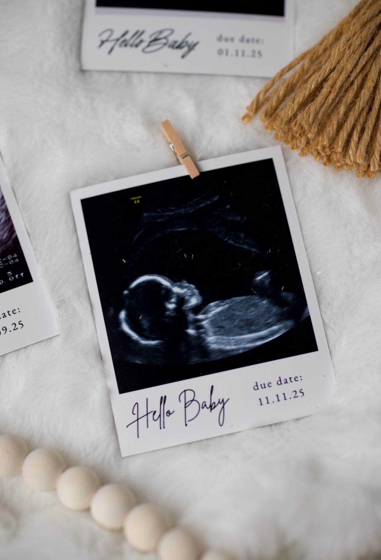 Custom First Image Ultrasound Magnet